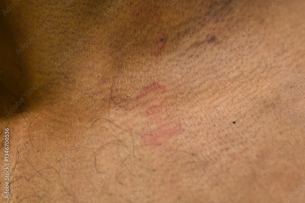Fototapeta premium Marks on skin after intense physical activity in gym