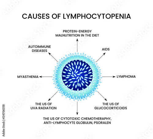 Causes of Lymphocytopenia Comprehensive Overview