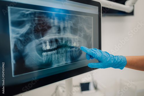 Dentist pointing at dental x ray on computer screen showing teeth and jaw