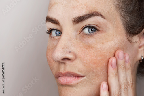 Close up caucasian woman's face with freckles or age spots. Age spots on the face. Woman with blue eyes looks at camera photo