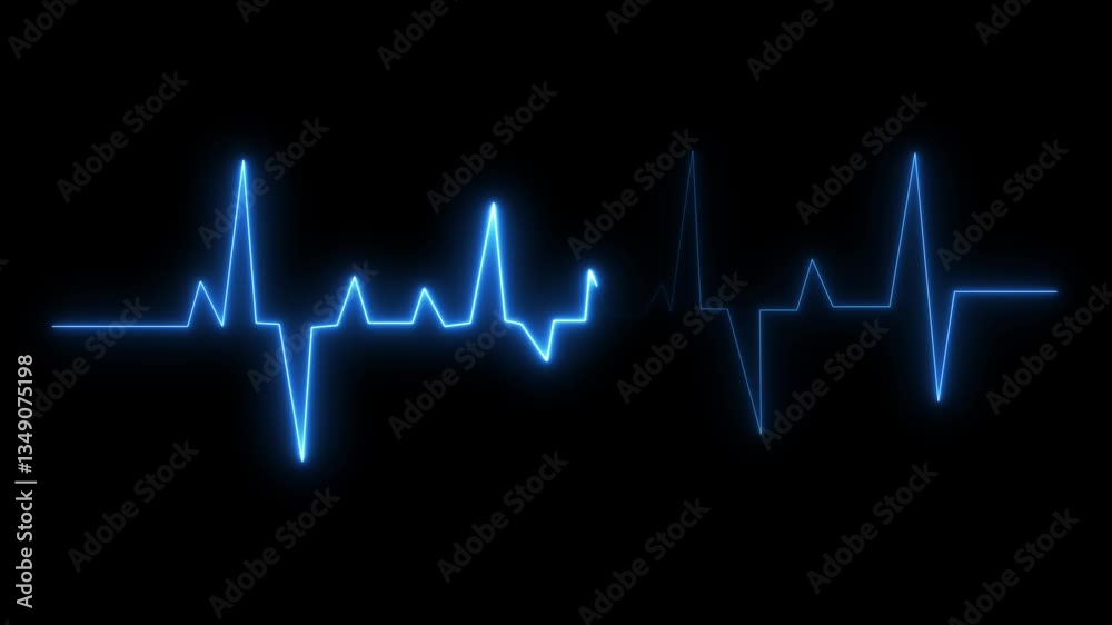 Abstract heartbeat and pulse rate signal animation on black background. Abstract heartbeat and pulse rate signal animation on black background.