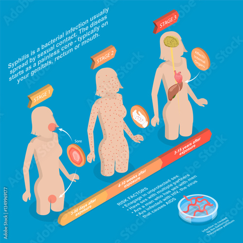 3D Isometric Flat Vector Illustration of Syphilis, STD, Sexual Transmitted Diseases