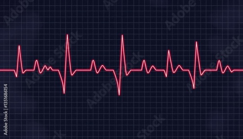 Irregular heartbeat graph with arrhythmia patterns on ECG grid