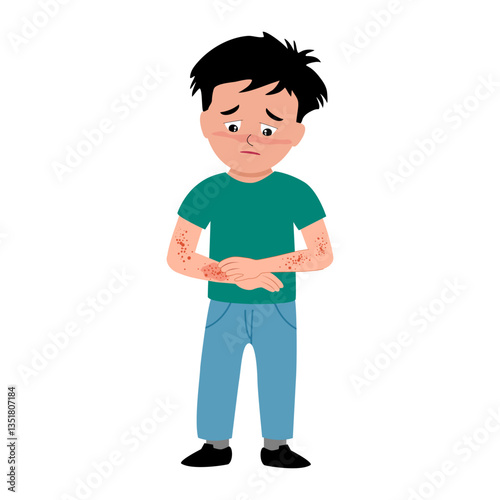 cute little boy scratching his itchy arm suffering from measles rash allergy skin