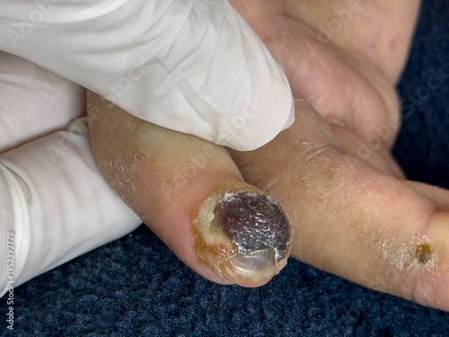 Medical themes: Close up of female patient with scleroderma
