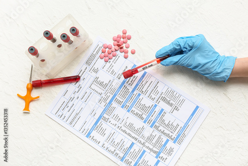 Doctor with HIV blood test ...