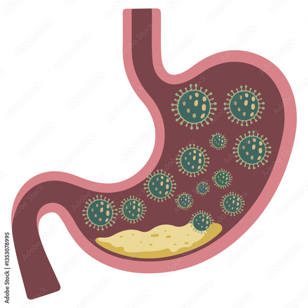 Fototapeta premium Medical illustration of a viral stomach��
