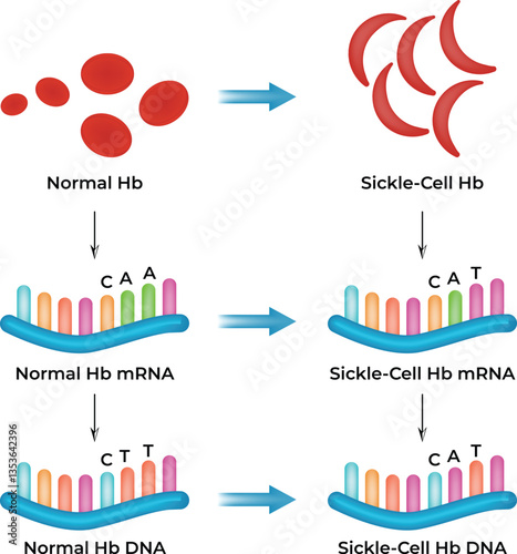 Sickle Cell Anemia DNA mRNA and Hemoglobin Mutation Vector Illustration