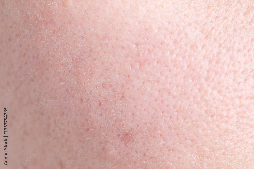 Texture of skin with enlarged pores as background, closeup Texture of skin with enlarged pores as background, closeup