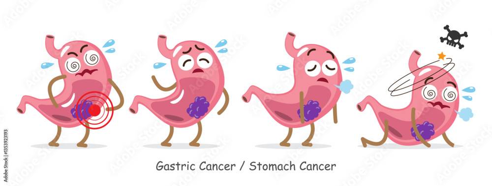 Obraz premium Gastric cancer or stomach cancer . Cute medical cartoon characters . Isolated white background . Vector .