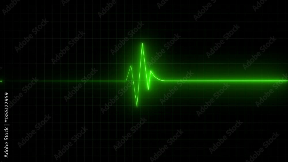 Heart rate monitor electrocardiogram beautiful bright glowing, Health- medicine and human heart concepts.Medical monitor displaying cardiograph pulse checkup.