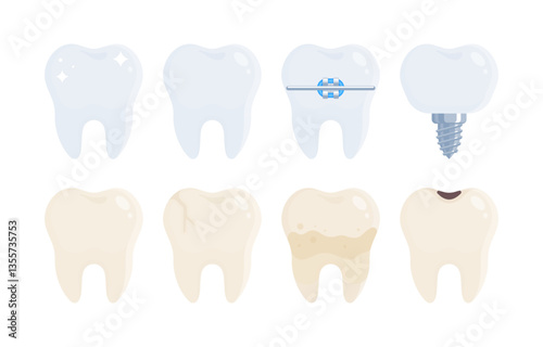 Set of healthy and damaged teeth. Tooth with braces, tartar, cavity and implant. Dentistry, dental care, orthodontics, oral health concept. Flat vector illustration isolated on white background