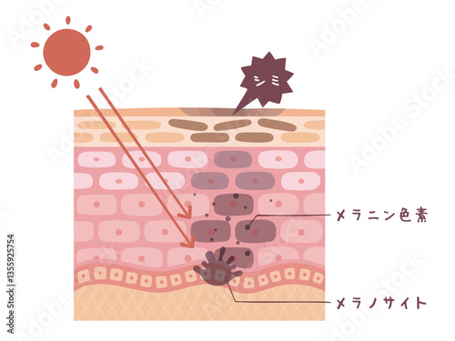 肌の断面図で見るシミが出来る図解イラスト
