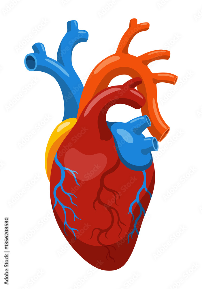 Atherosclerosis stage. Anatomy of heart attack. Arteriosclerotic vascular disease or ASVD. illustration on white background