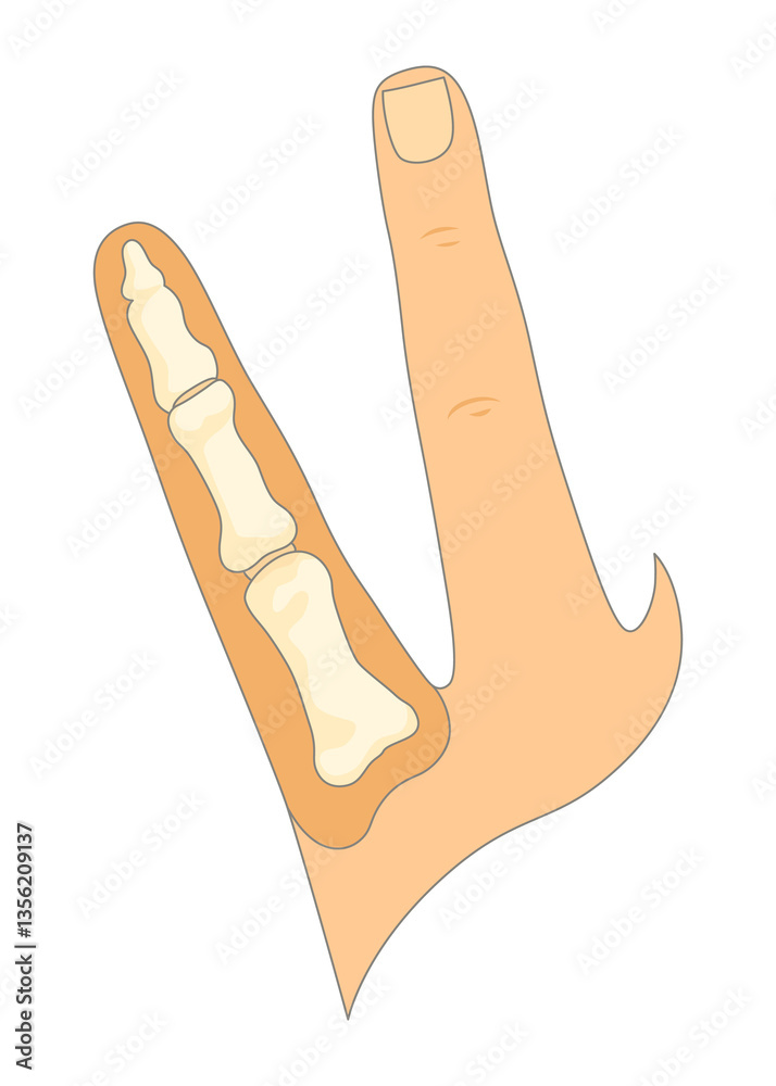 Bones type skeleton. Educational anatomical diagram element. Bone example. Educational medical illustration
