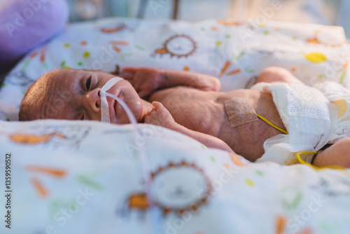 Premature baby with nasal tube looking up in incubator