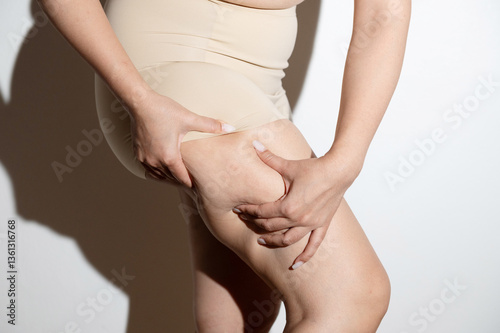 Wallpaper Mural Close-up of a woman pinching skin on her thigh, highlighting cellulite and body texture under natural lighting for skincare context.
 Torontodigital.ca