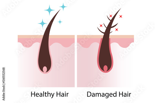 Healthy vs Damaged Hair Follicle – Hair Care & Scalp Health Vector