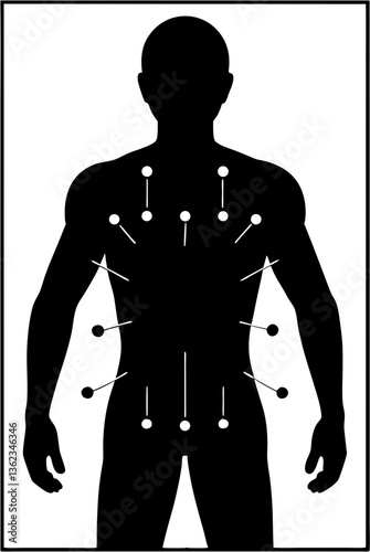 A person receiving acupuncture with needles placed on specific body points, isolated on white background.
