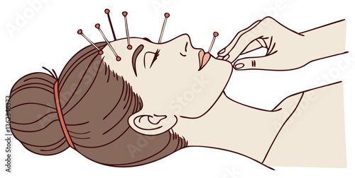 A person receiving acupuncture with needles placed on specific body points, isolated on white background.
