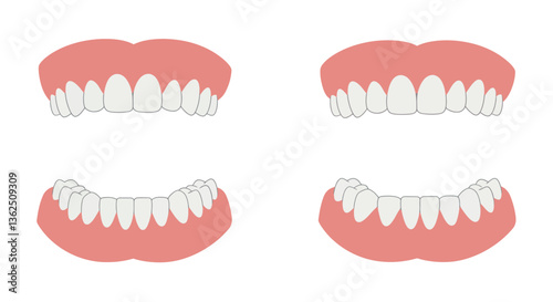 Detailed illustration of teeth alignment changes in flat vector art
