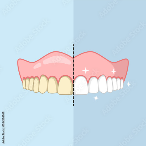 Clean and dirty teeth, whiten or clean teeth illustration