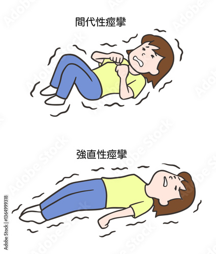 間代性痙攣と強直性痙攣、女性