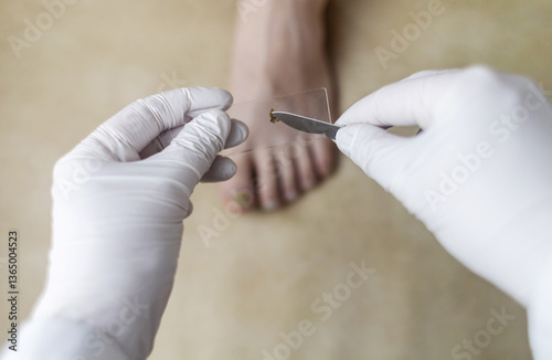 A podiatrist takes a scraping from a nail to examine for a fungal infection. Microbiological examination, taking a swab for the treatment of nail disease