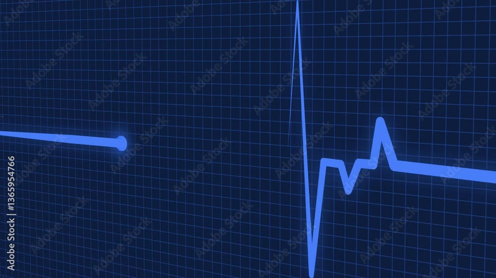Electrocardiogram Heartbeat Line Graph Animation, A electrocardiogram ...
