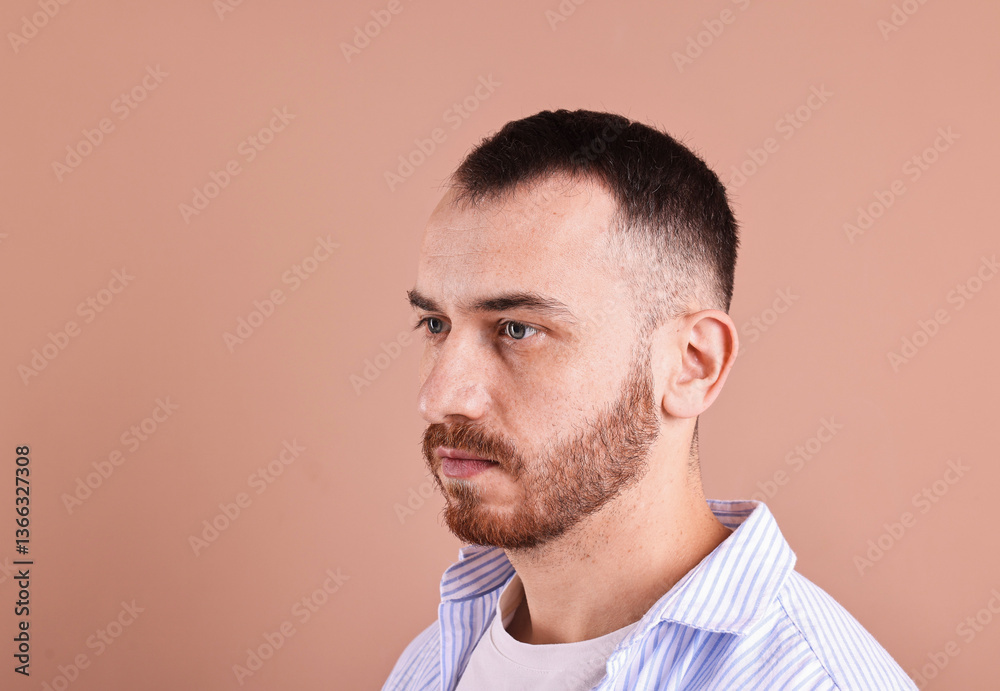 Obraz premium Baldness problem. Man with receding hairline on dark beige background, space for text