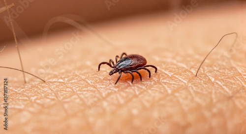 Close-up tick on human skin