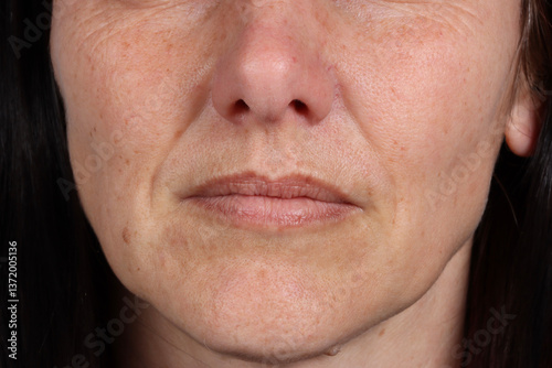A close-up frontal view of a 40-year-old Caucasian woman's face, showcasing natural wrinkles around her mouth
