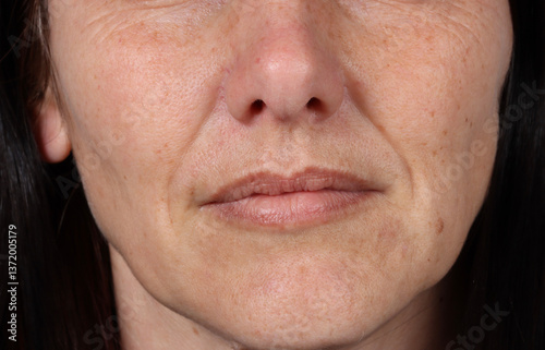 A close-up frontal view of a 40-year-old Caucasian woman's face, showcasing natural wrinkles around her mouth