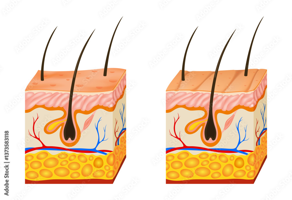 Oily and dry skin anatomy. Human body skin vector illustration with parts vein artery hair sweat gland epidermis dermis and hypodermis. Human Cross-section of the skin layers structure