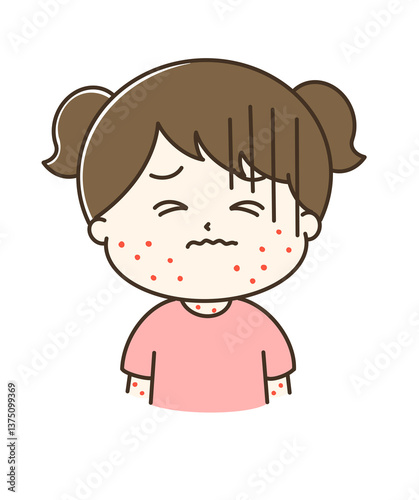 赤い発疹が出ている女の子の上半身のゆるかわイラスト