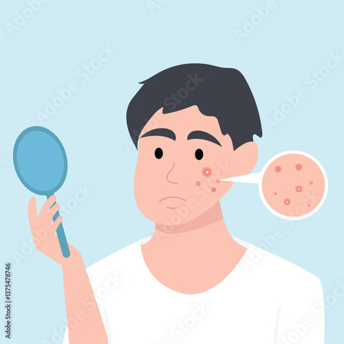 Teenager boy has skin problems with acne or allergic pimples on her face. Skincare and dermatology concept. Flat style vector illustrationv