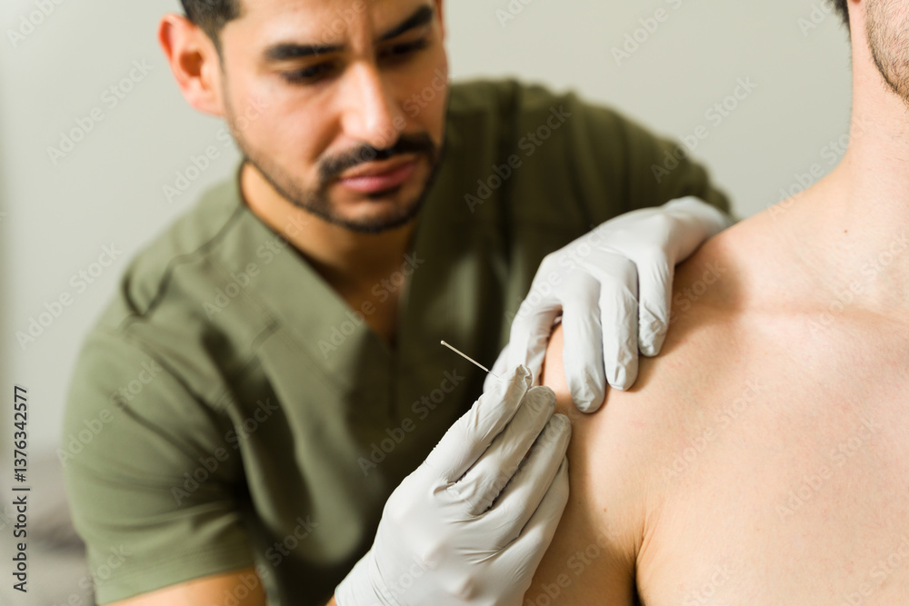 Professional physiotherapist performing dry needling treatment on male patient's shoulder, targeting muscle tension and pain relief