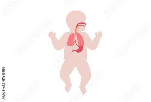 Aspiration pneumonia poster