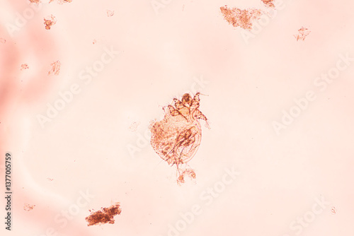 Image of pubic lice in microscopy from urine specimen.Pthirus pubis or Pediculosis pubis living according to pubic hair and the human body.Human parasite concept.