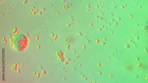 Algal Bloom in freshwater collected from pond - 400x magnification DIC microscope - single celled green algae
