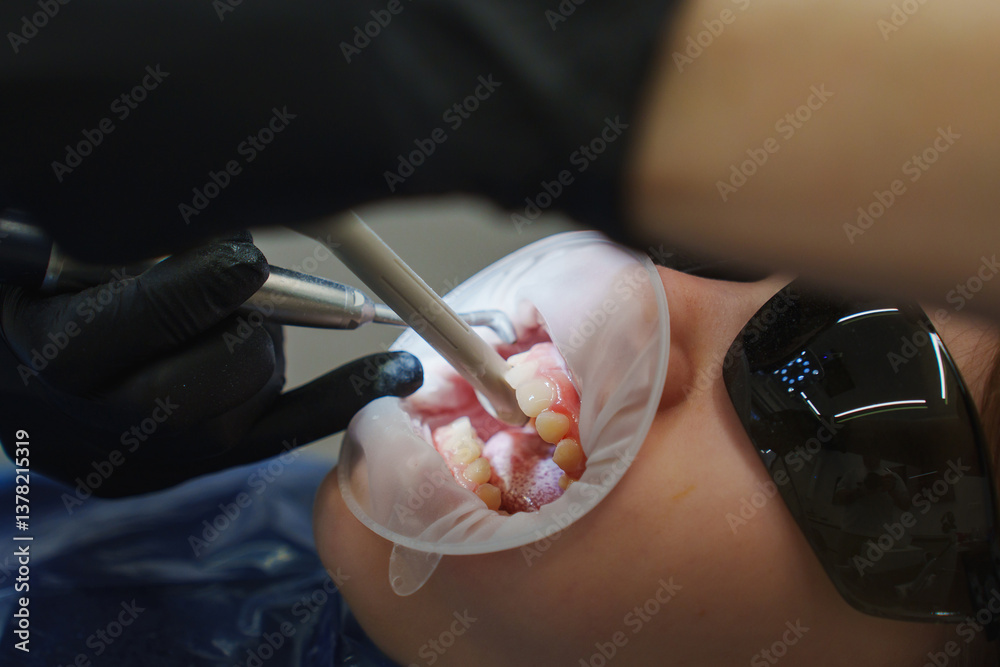 Professional dental hygiene treatment for children in a dental clinic