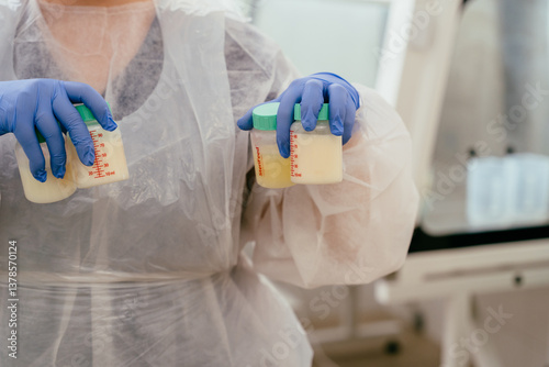 Hands in blue gloves hold two labeled breast milk bottles in sterile medical environment. Stored and handled safely for neonatal feeding support.