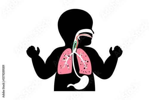 Aspiration pneumonia poster