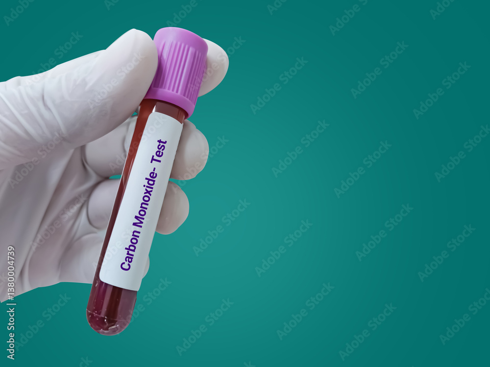 Naklejka premium Scientist hold blood sample for Carbon Monoxide test. Healthcare and medical test concept.