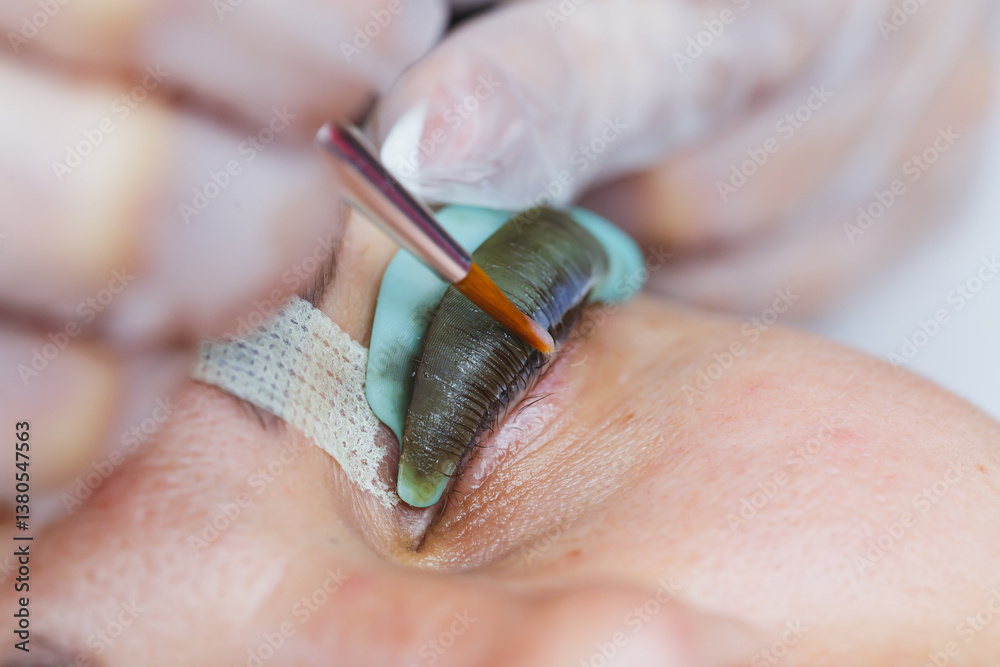 Innovative Eye Treatment Procedure A detailed closeup of the unique leech application technique designed specifically for natural healing and rejuvenation of the eyes and surrounding areas