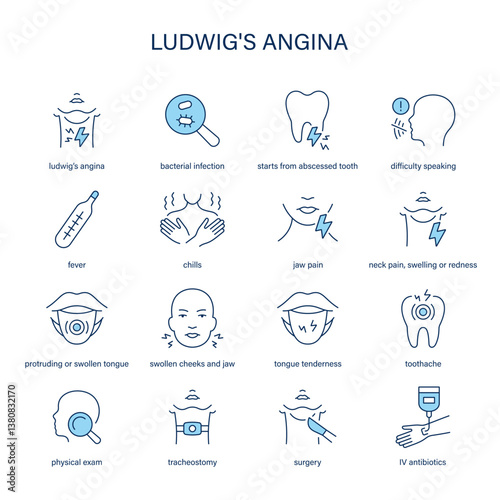 Ludwig's Angina symptoms, diagnostic and treatment vector icon set. Medical icons.
