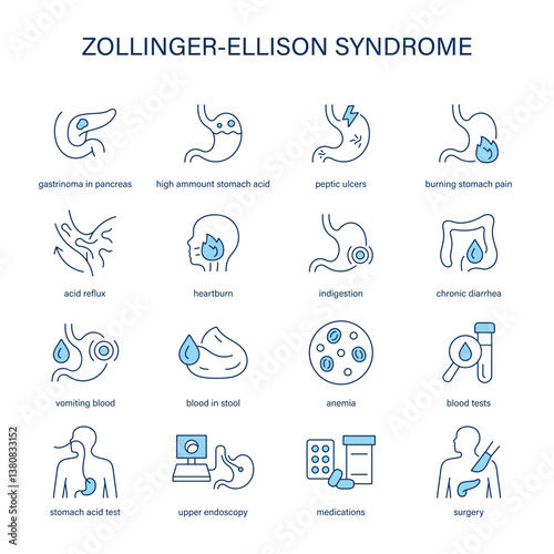 Zollinger-Ellison Syndrome symptoms, diagnostic and treatment vector icons. Medical icons.
