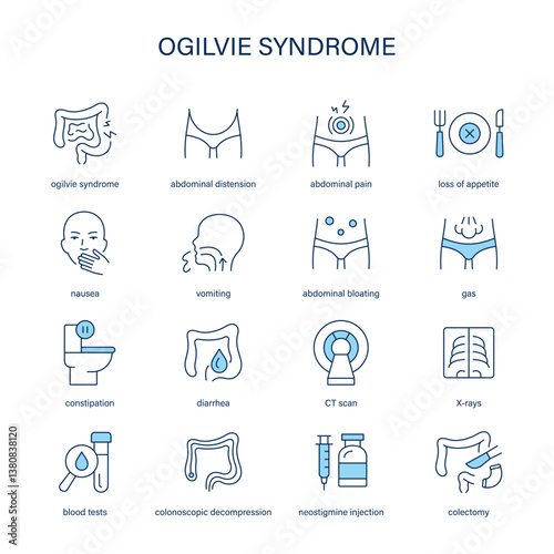Ogilvie Syndrome symptoms, diagnostic and treatment vector icons. Medical icons.