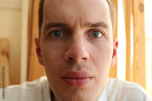 Young man face with big nose and anxious eyes close up.