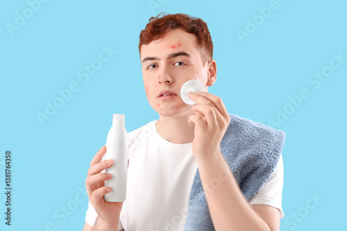 Teenage boy with remedy for...